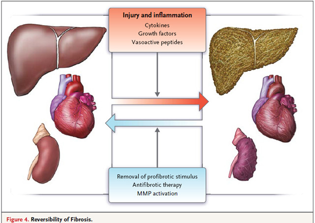 逆转器官纤维化，MSC在行动！