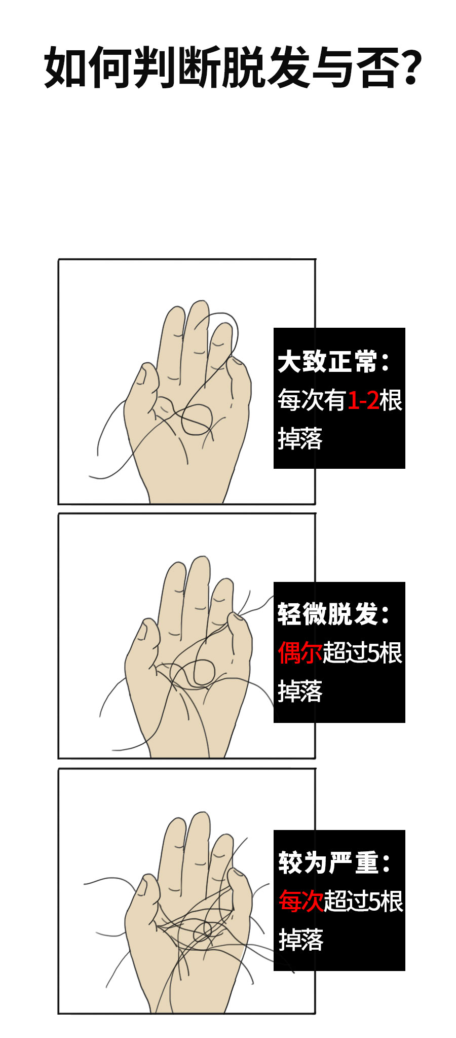 脱发_04.jpg