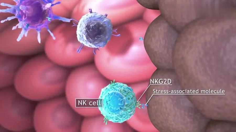免疫治疗时代 ，浅谈NK细胞在肿瘤治疗中的临床应用