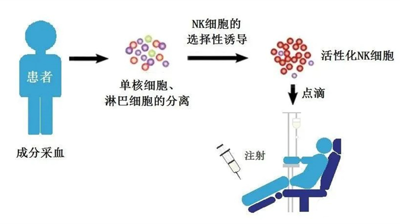 77 NK细胞培养治疗流程.jpg