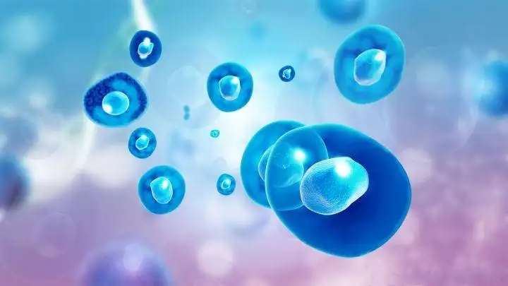 湘雅医院发布最新干细胞治疗银屑病结果，女性比男性更有效，有效率高达67%