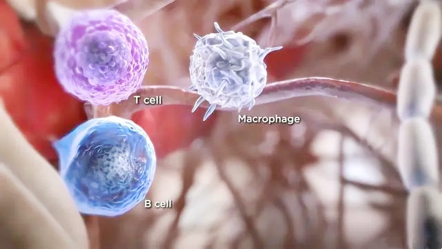 免疫细胞，乳腺癌治疗的“潜力股”