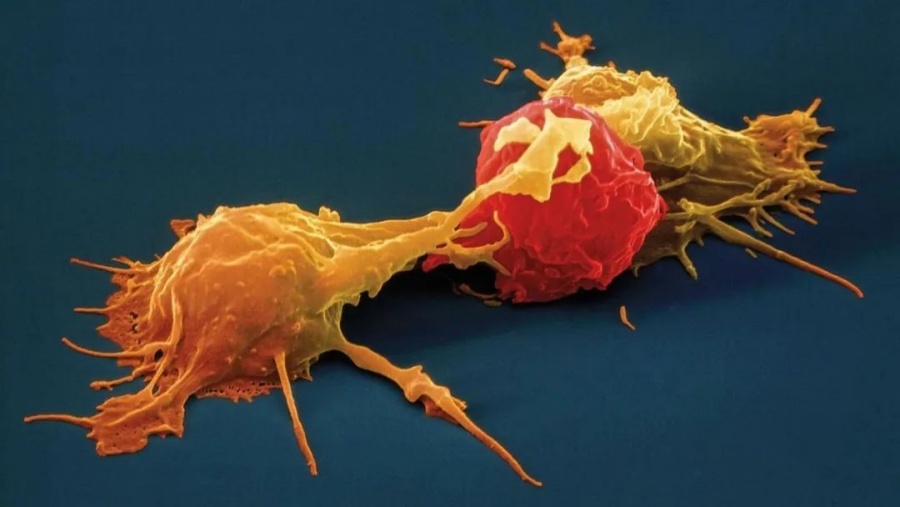 杀灭最凶悍的癌细胞？NK细胞的抗癌作用远超你的想象！